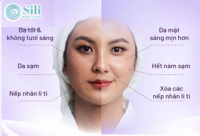cấy trắng da mặt