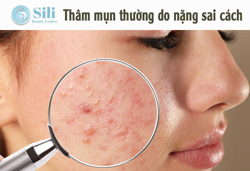 trị thâm hiệu quả