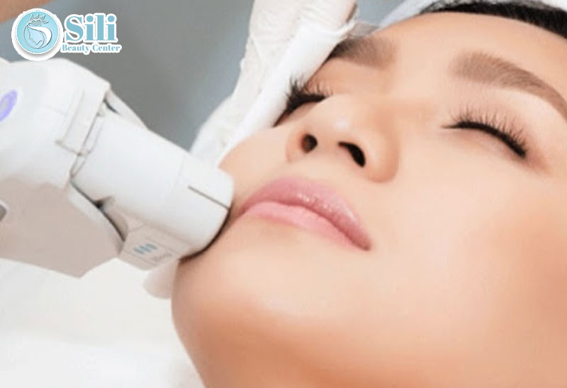 triệt lông mép