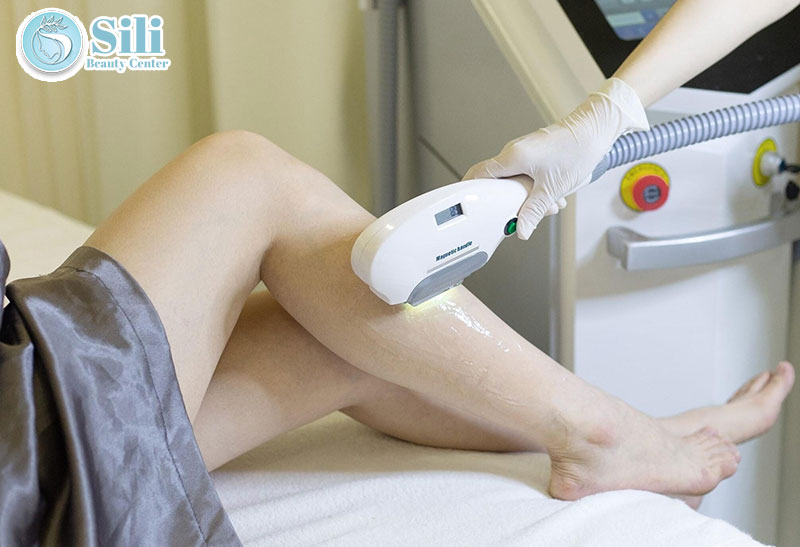 triệt lông vĩnh viễn