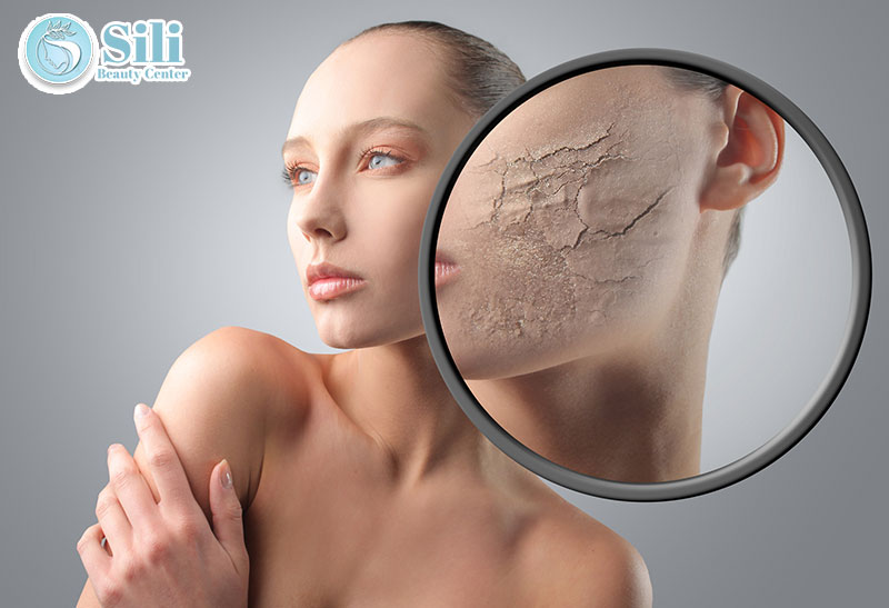 điều trị da tổn thương do mỹ phẩm
