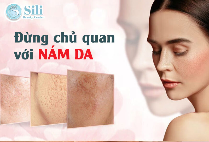 Đừng chủ quan khi bị nám da
