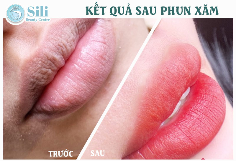 kết quả phun xăm môi tại Sili Beauty Center