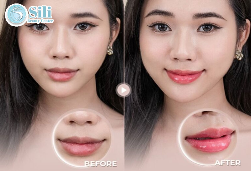 kết quả phun xăm môi tại Sili Beauty Center