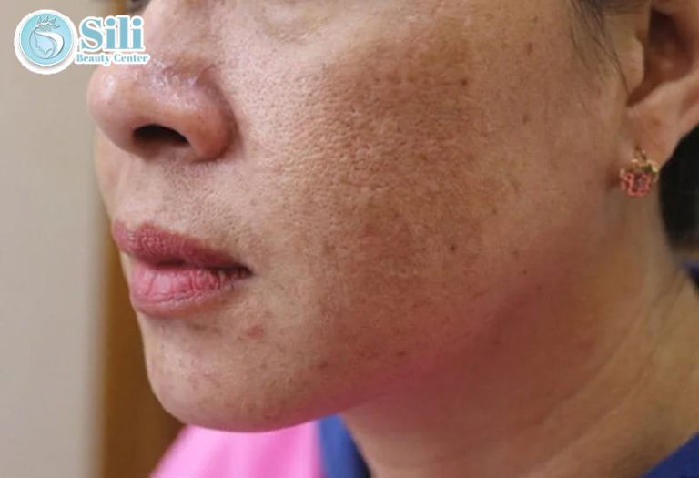 nám mảng