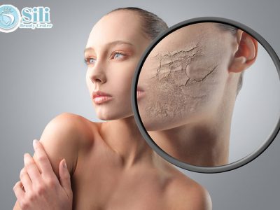 điều trị da tổn thương do mỹ phẩm