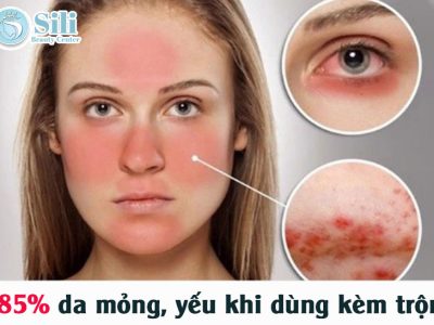 da yếu sau kem trộn