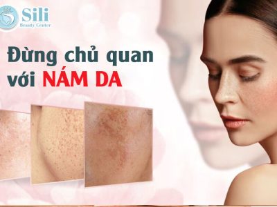Đừng chủ quan khi bị nám da