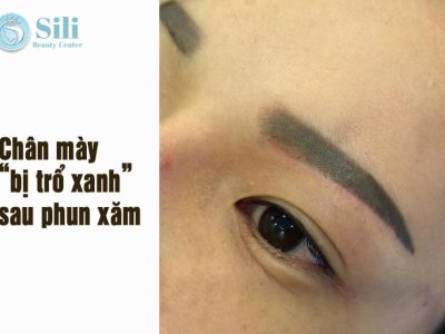 phun mày bị trổ xanh