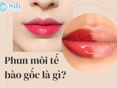 phun môi tế bào gốc là gì
