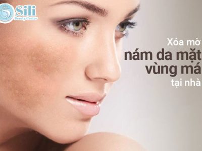 trị nám tại nhà