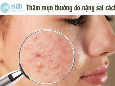 trị thâm hiệu quả