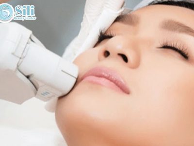 triệt lông mép