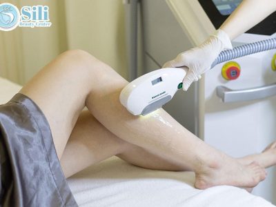 triệt lông vĩnh viễn