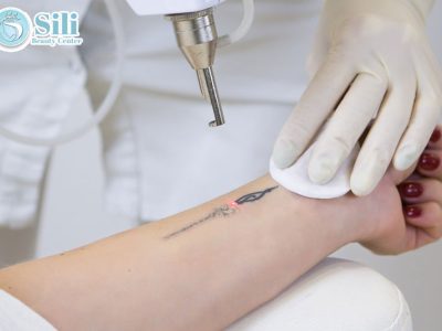 xóa xăm an toàn không đau